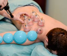 Cupping 2
